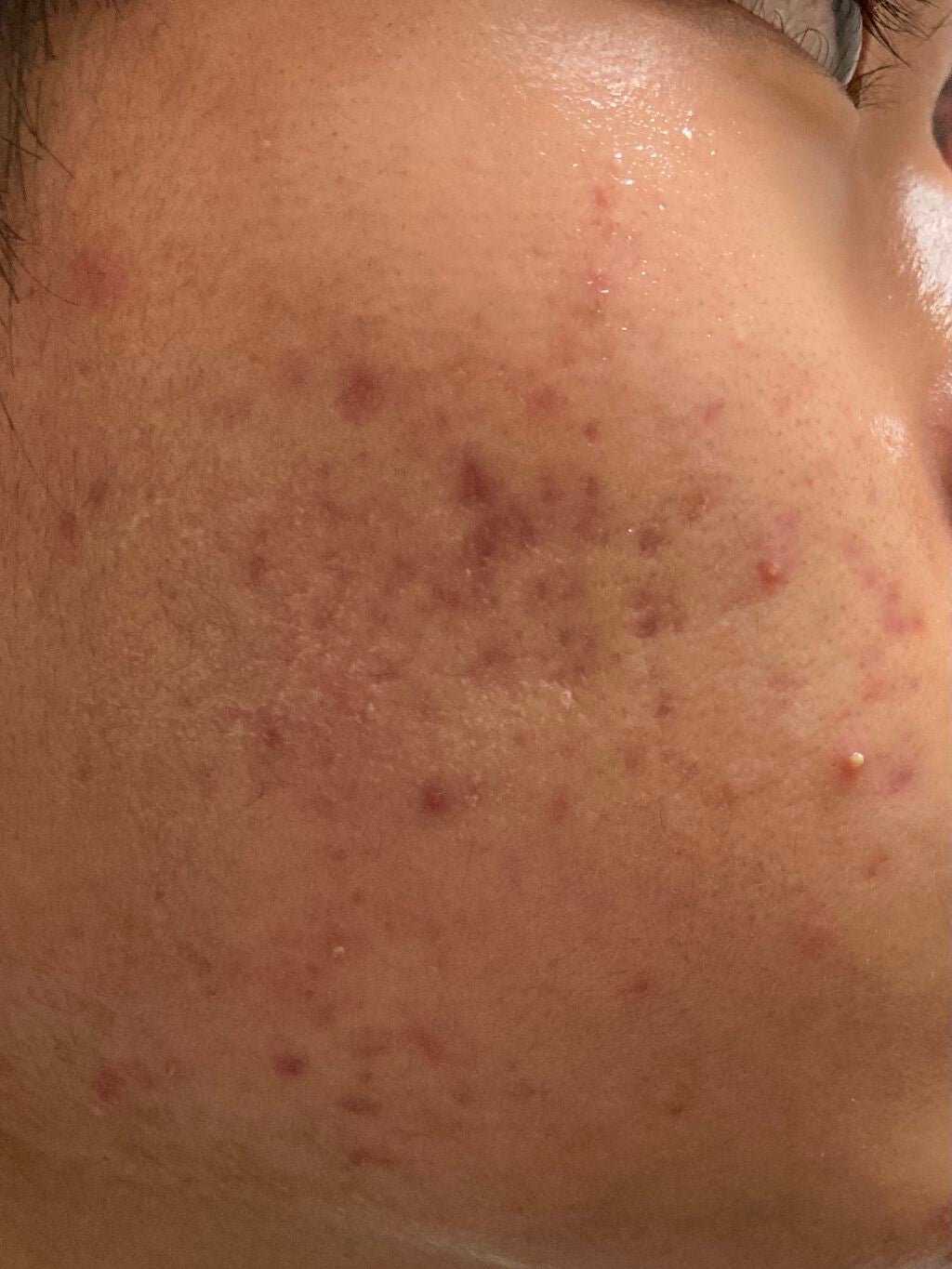 白色ワセリン(医薬品)/健栄製薬/その他を使ったクチコミ(2枚目)