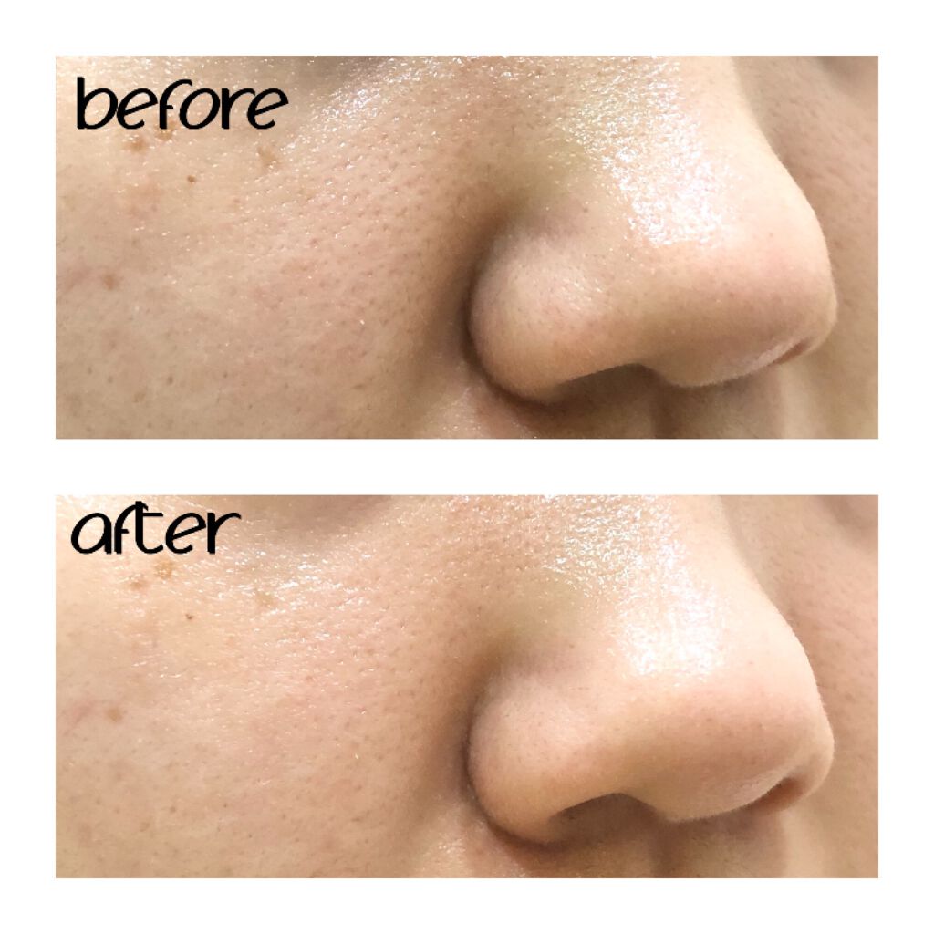 エマルジョンリムーバー 300ml/200ml/水橋保寿堂製薬/その他洗顔料を使ったクチコミ(7枚目)