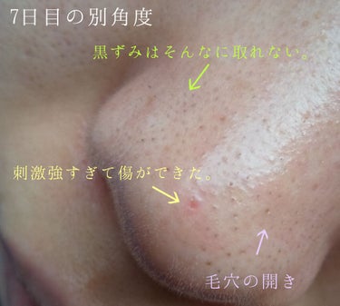 Pore control Blackhead off sheet ビューティシート/Ciracle/シートマスク・パックを使ったクチコミ（3枚目）