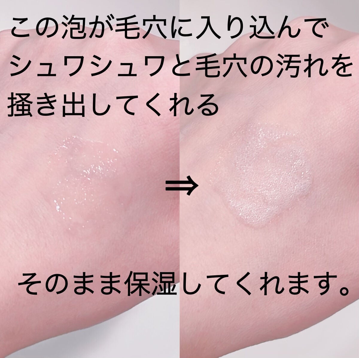 マジックバブルエッセンスパック(ピンク) /BAKER7/洗い流すパック・マスクを使ったクチコミ(3枚目)