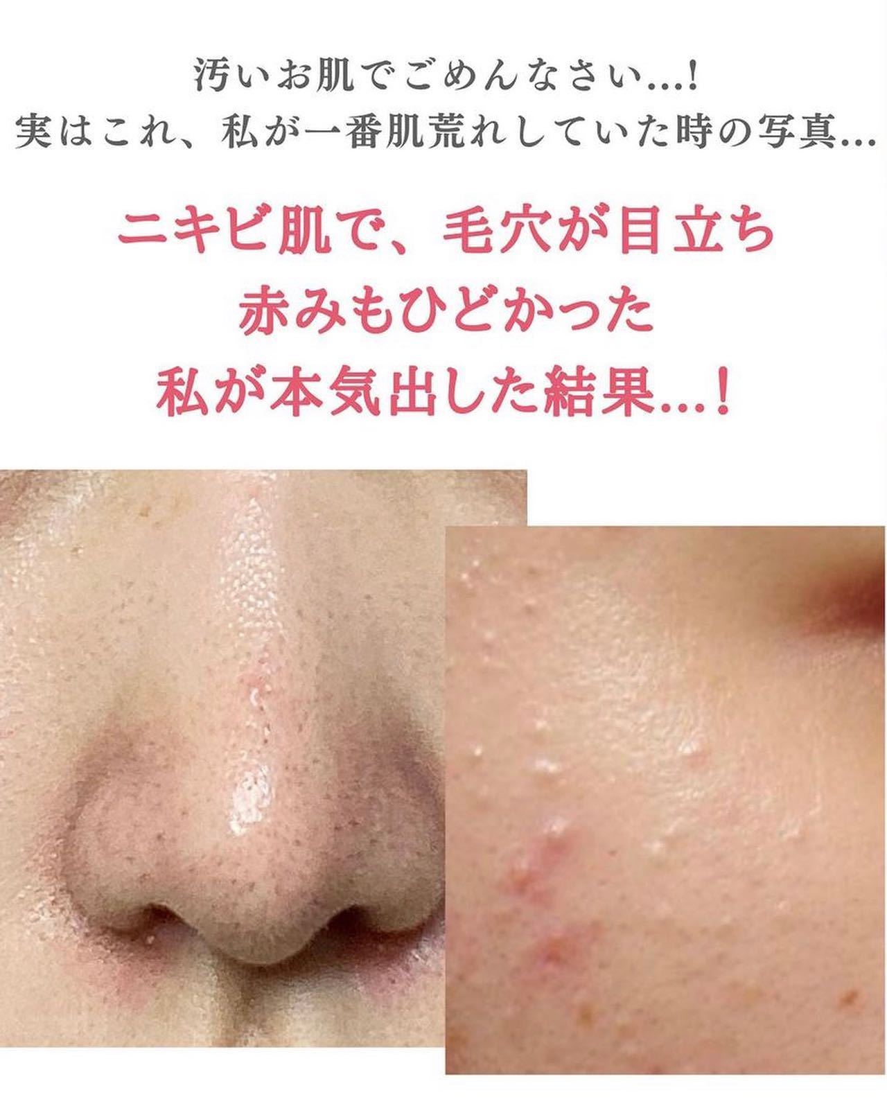 BRIGHTENING WASH/SHIKARI/その他洗顔料を使ったクチコミ（2枚目）