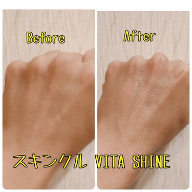 VITA SHINE 薬用美白VC美容液/スキンクル/美容液を使ったクチコミ（3枚目）