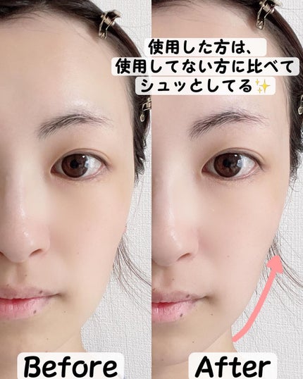 イオン導入美顔器フォトマックス /ar&ar /美顔器・マッサージを使ったクチコミ(7枚目)