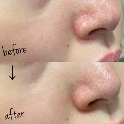 ソフィーナ iP ポア クリアリング ジェル ウォッシュ/SOFINA iP/その他洗顔料を使ったクチコミ(4枚目)