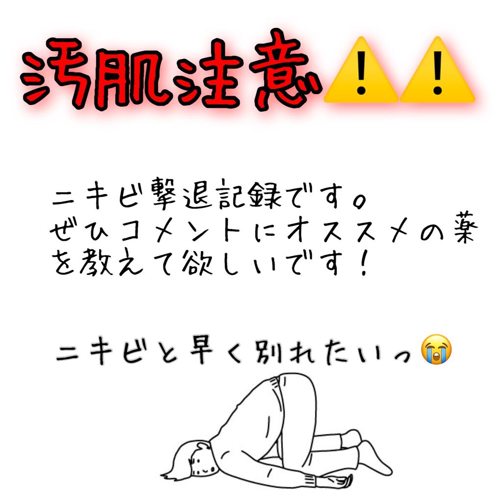 ペアアクネクリームW(医薬品)/ペア/その他を使ったクチコミ(1枚目)