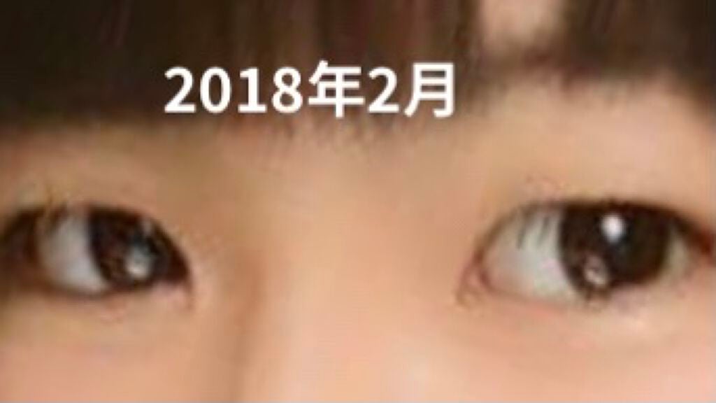 ダブルアイリッド/DAISO/二重まぶた用アイテムを使ったクチコミ(2枚目)