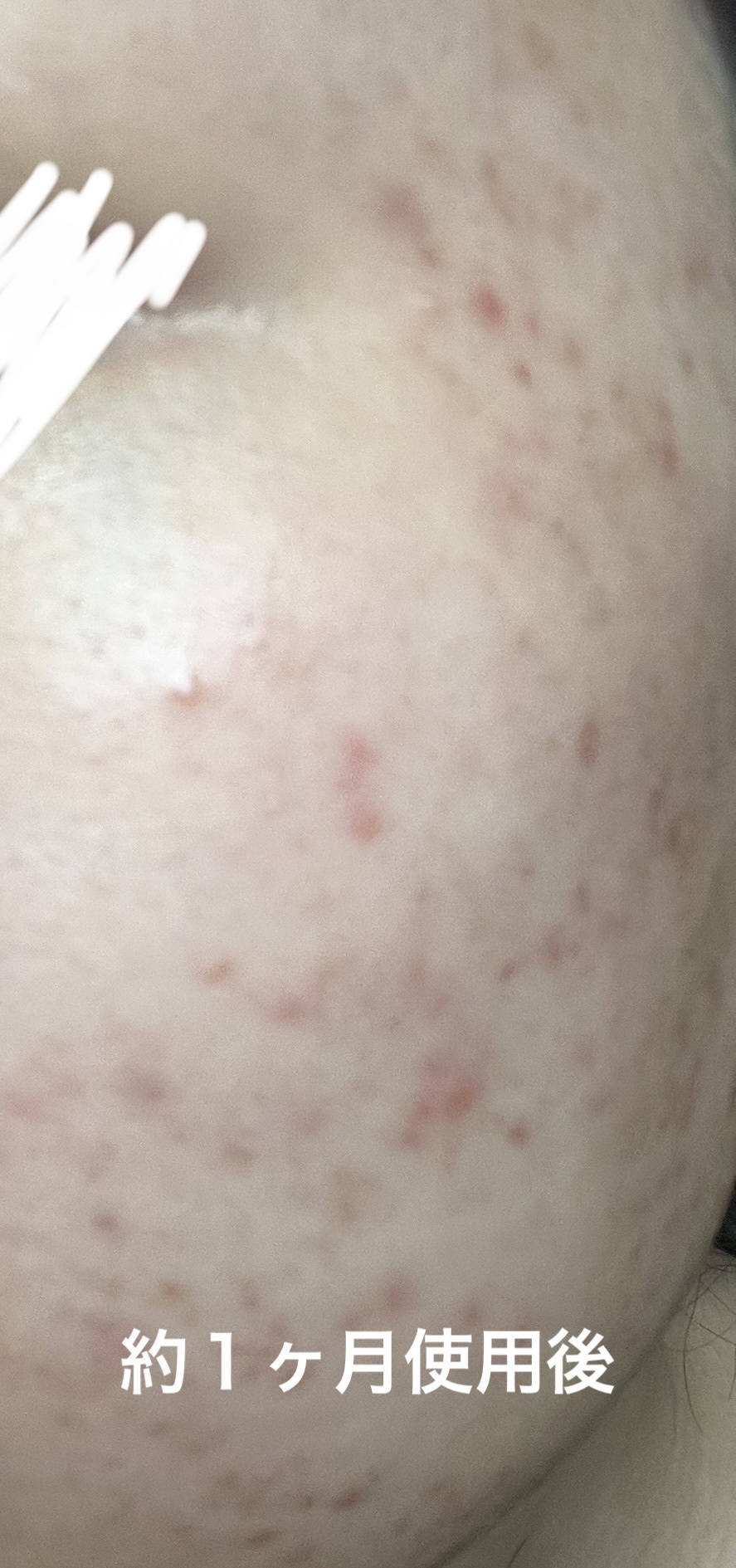 クリアフル トライアルセット L/オルビス/トライアルキットを使ったクチコミ（3枚目）