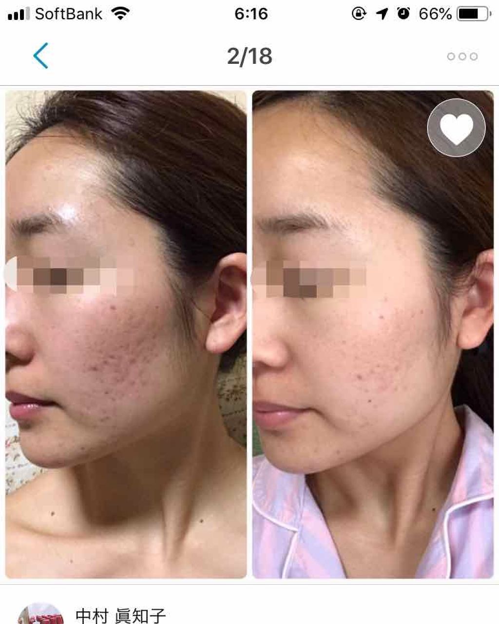 を使ったクチコミ（3枚目）