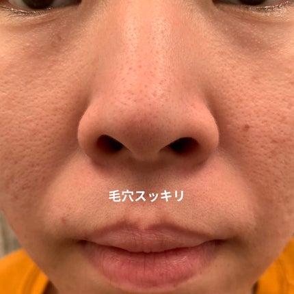 パフォーマンスツール トライアルセット/LOGIC/トライアルキットを使ったクチコミ(7枚目)