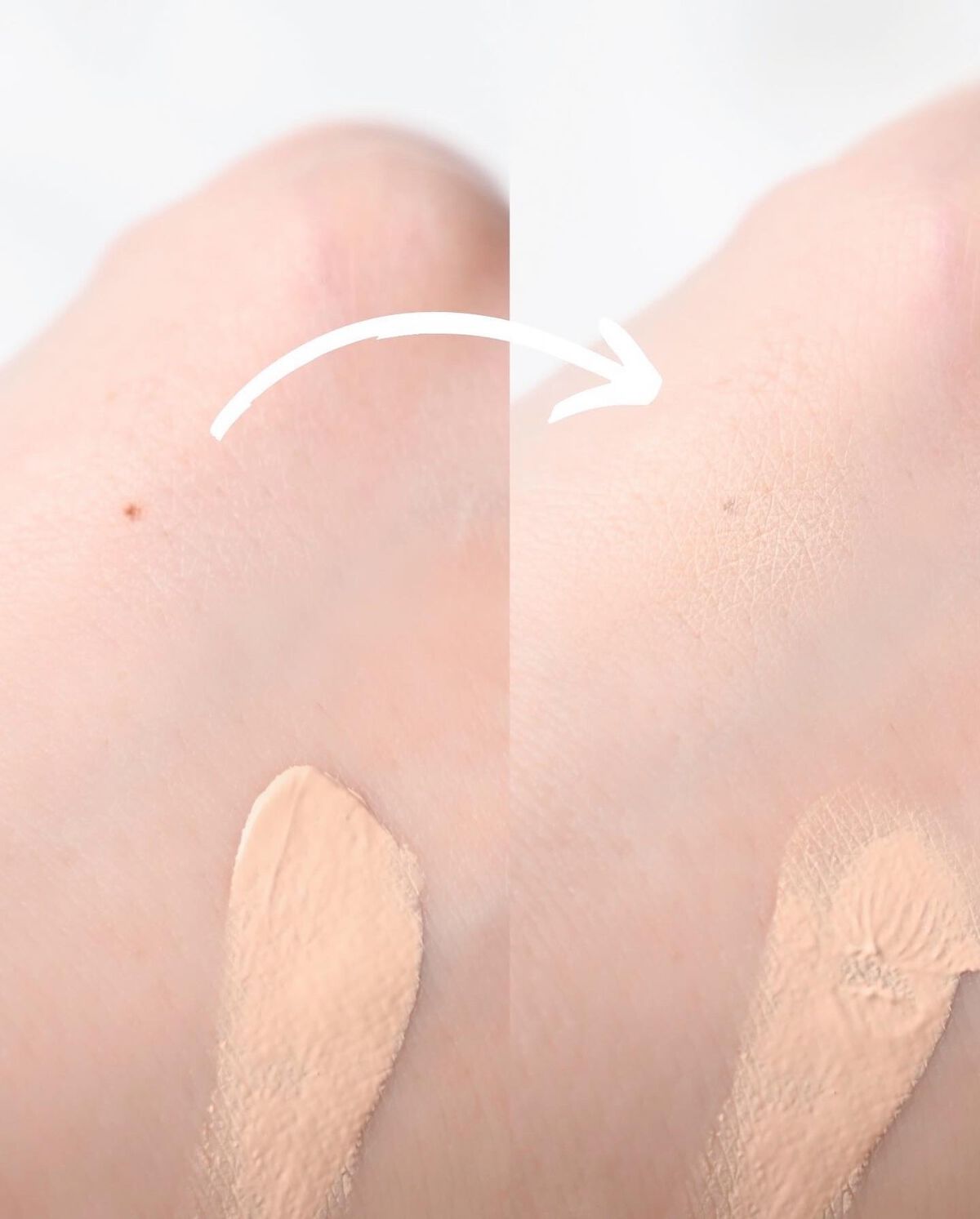 イプノス シーバムクリア リペアクリーム/ACSEINE/フェイスクリームを使ったクチコミ(1枚目)