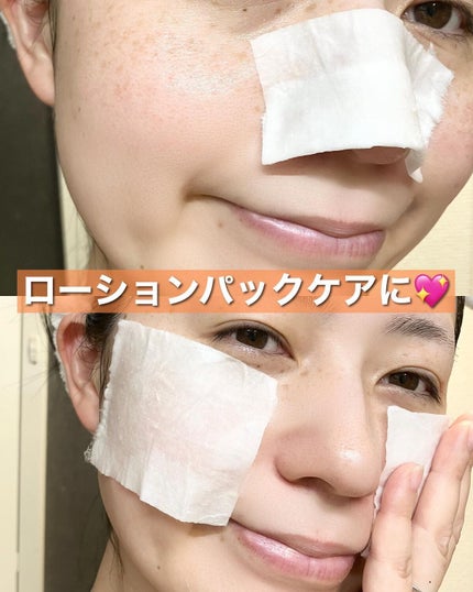 VC100エッセンスローション EX/ドクターシーラボⓇ/化粧水を使ったクチコミ(6枚目)