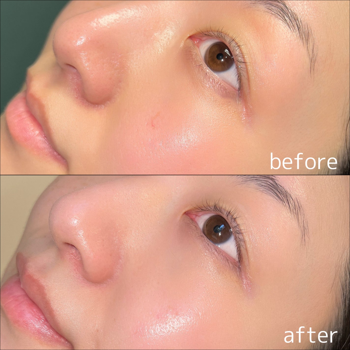 サンデートーンアップサンセラム/EDIT.B/美容液を使ったクチコミ(5枚目)