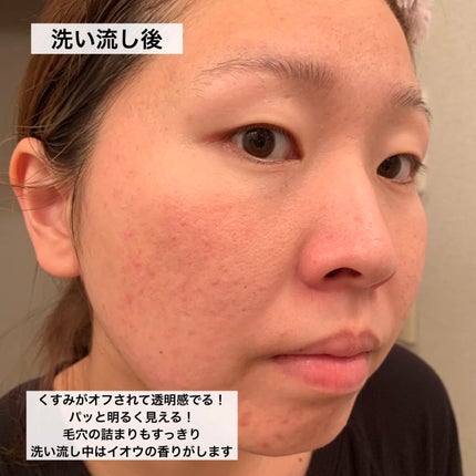 SFパック/iow/洗い流すパック・マスクを使ったクチコミ(8枚目)