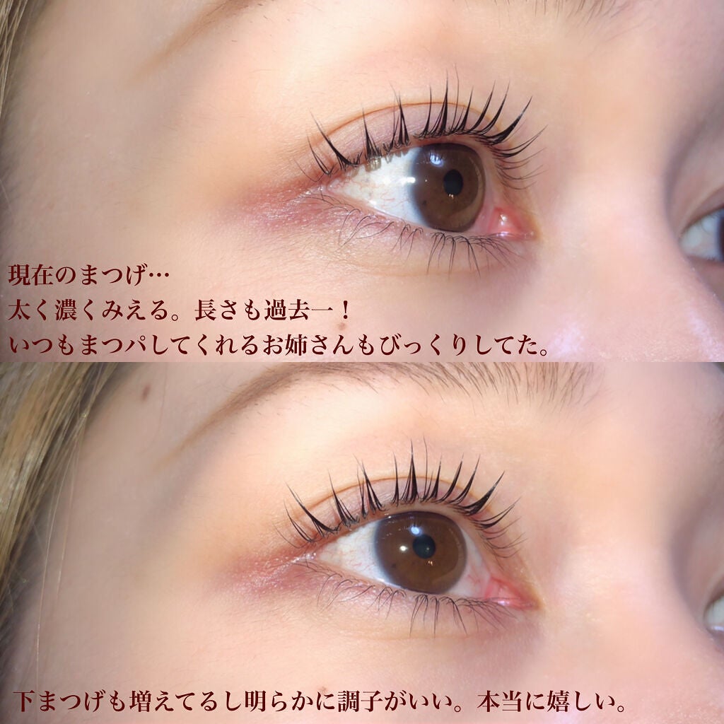 アヴァンセ ラッシュセラム EX(医薬部外品)/アヴァンセ/その他を使ったクチコミ(2枚目)