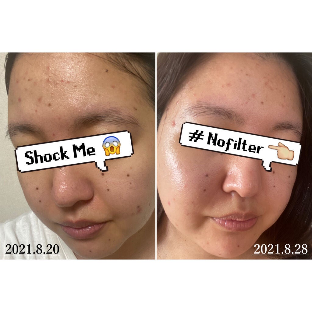 エレメンタリー フェイスクレンジングクリーム/ITRIM/クレンジングクリームを使ったクチコミ(8枚目)