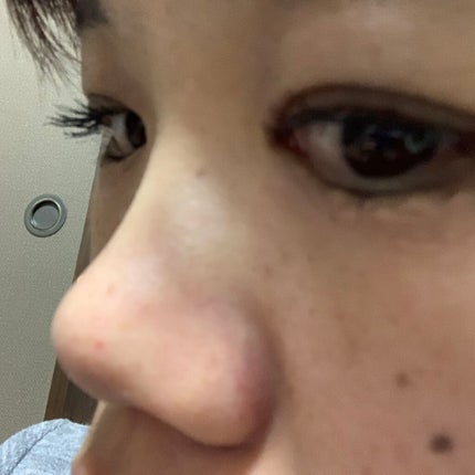 アヴァンセ ラッシュセラム EX(医薬部外品)/アヴァンセ/その他を使ったクチコミ(2枚目)