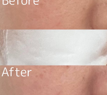 クリスタルホイップ/SHIRORU/泡洗顔を使ったクチコミ(4枚目)