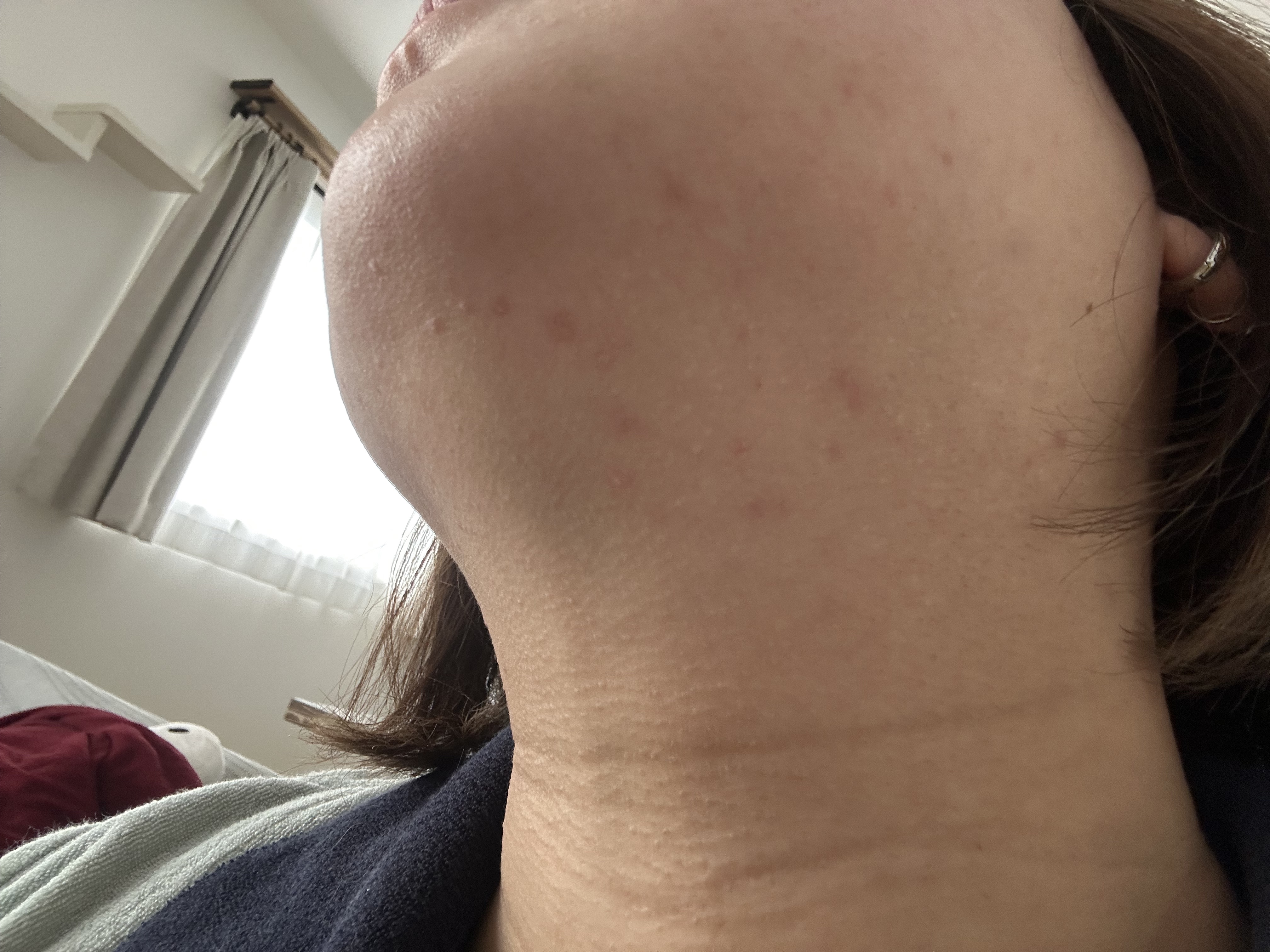 TXトーニングクリーム/VT/フェイスクリームを使ったクチコミ（2枚目）