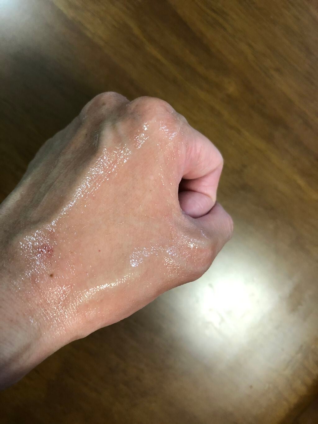 マイクロバイオプロモート リペアジェル/ナナローブ/オールインワン化粧品を使ったクチコミ(4枚目)