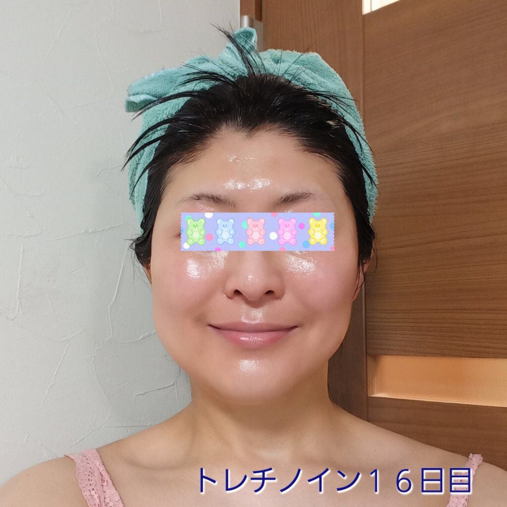 極潤α リフトクリーム/肌ラボ/フェイスクリームを使ったクチコミ(1枚目)