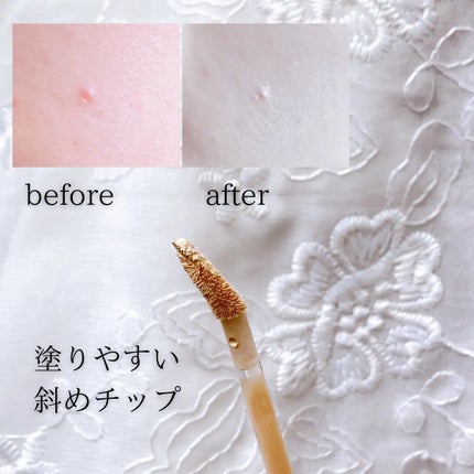 ダーマシンコンシーラー/23years old/リキッドコンシーラーを使ったクチコミ(4枚目)