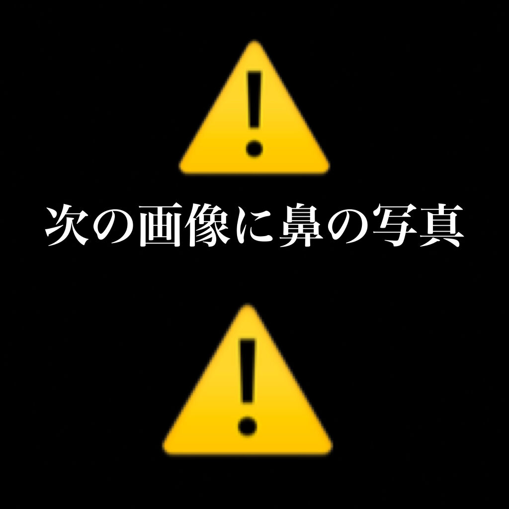 タカミエッセンスCE/タカミ/美容液を使ったクチコミ（3枚目）