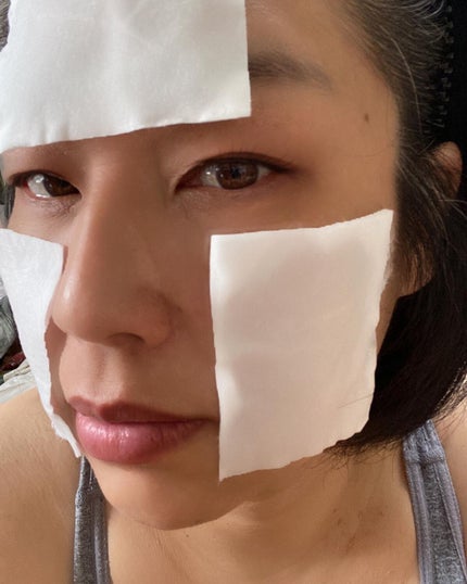 VC100エッセンスローション EX/ドクターシーラボⓇ/化粧水を使ったクチコミ(8枚目)