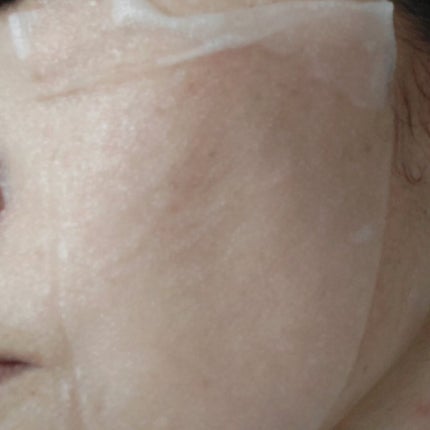 ダーマレーザースーパーVC100マスク/クオリティファースト/シートマスク・パックを使ったクチコミ(3枚目)