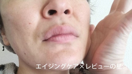 ビューティーオープナー/オージオ/美容液を使ったクチコミ(3枚目)