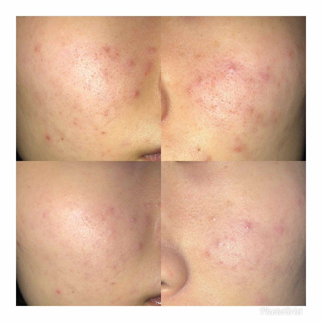 M クッション ファンデーション(モイスチャー)/MISSHA/クッションファンデーションを使ったクチコミ(1枚目)