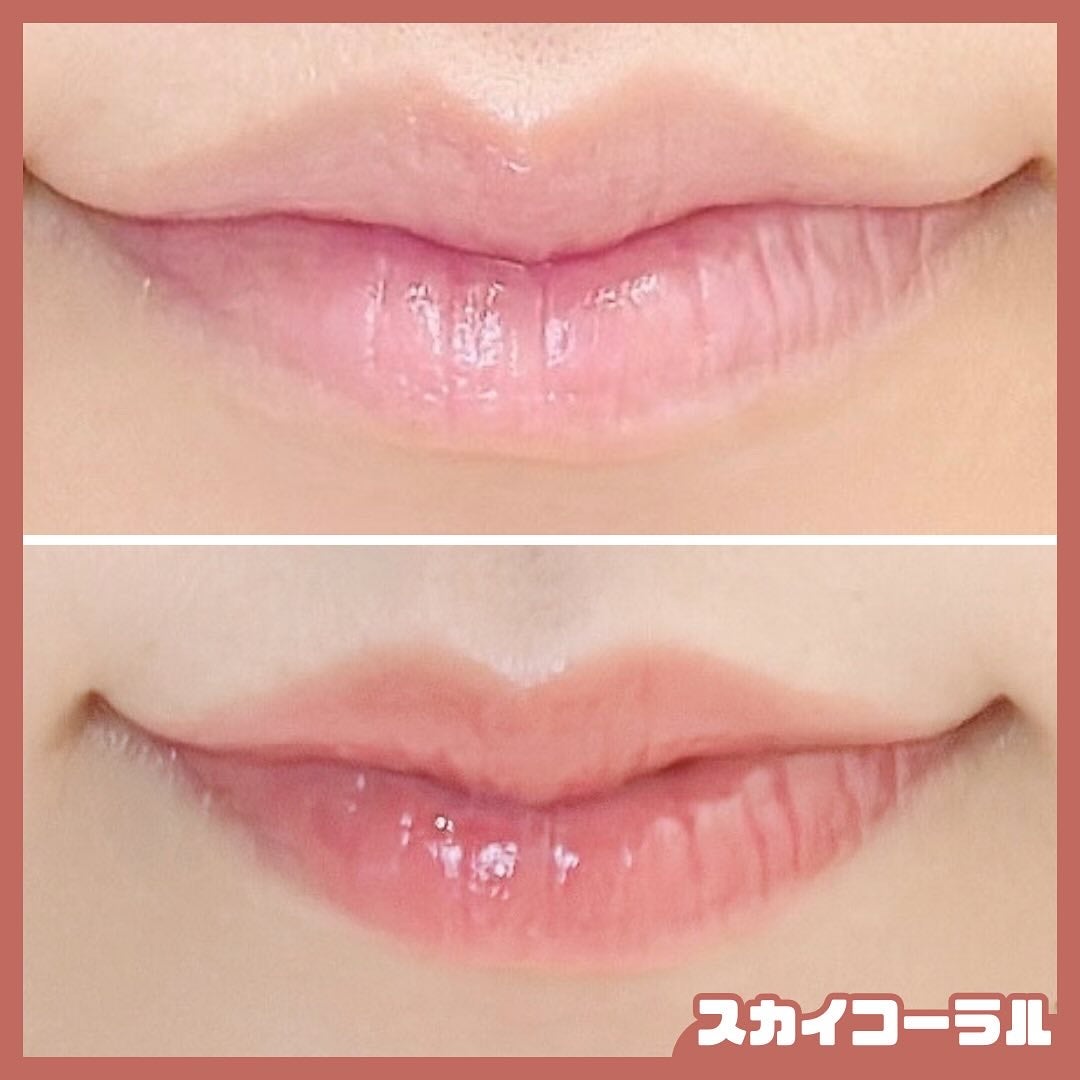 ユース ラディアンス ビタチノール セラム/primera/美容液を使ったクチコミ(4枚目)