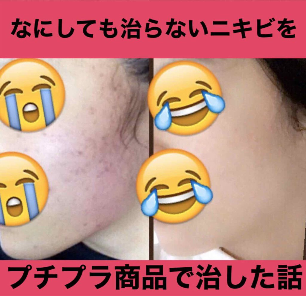 ハトムギ化粧水(ナチュリエ スキンコンディショナー R )/ナチュリエ/化粧水を使ったクチコミ(1枚目)