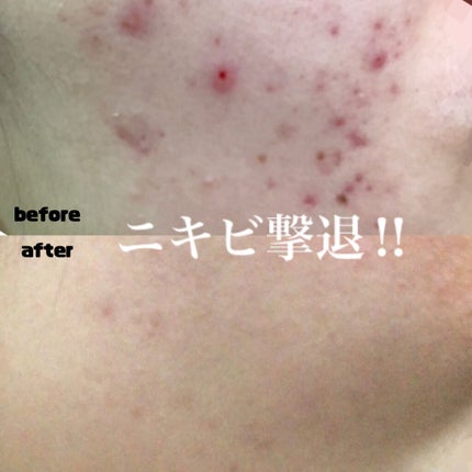 化粧水・敏感肌用・しっとりタイプ/無印良品/化粧水を使ったクチコミ(1枚目)