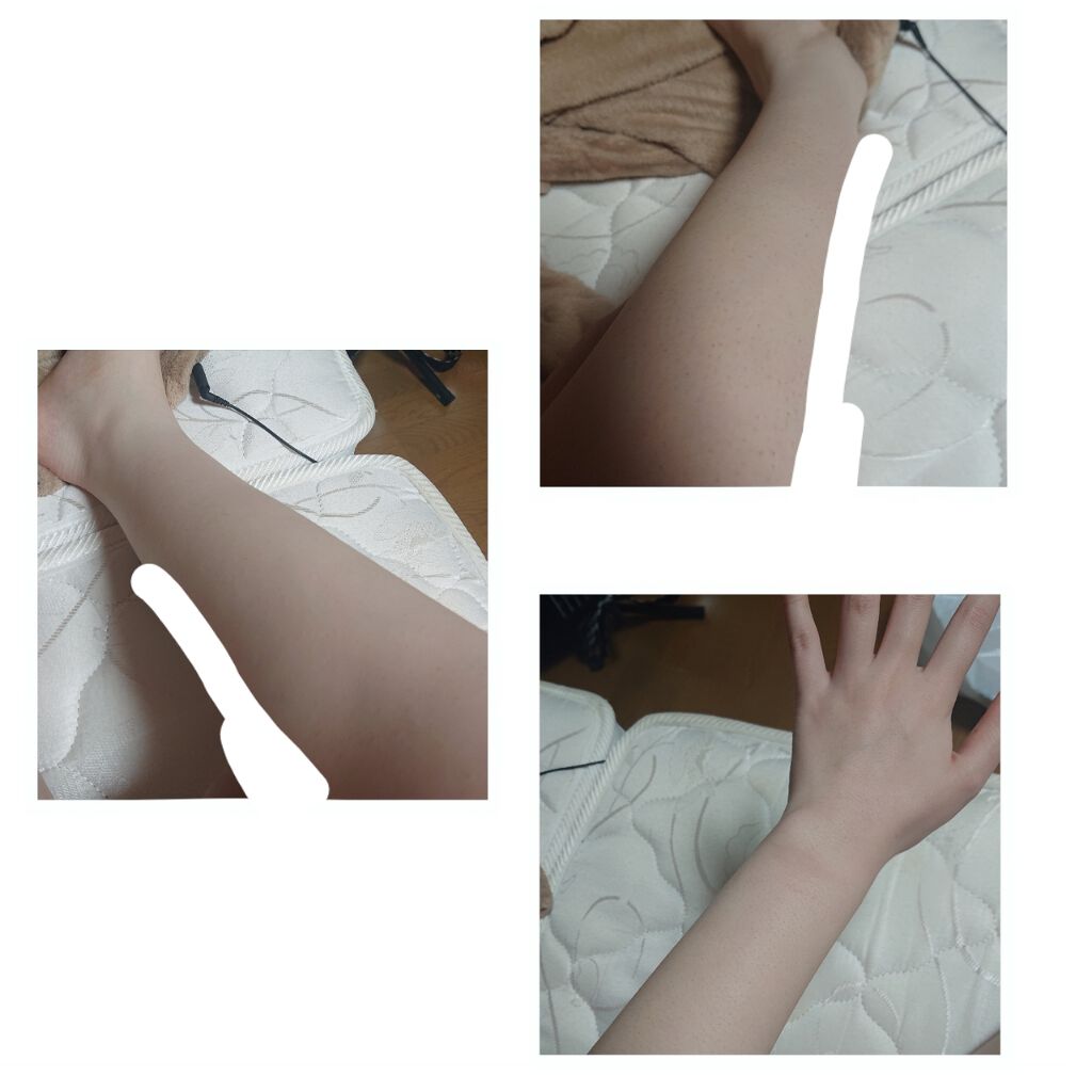 LOVE DOCK IPL光脱毛器/LOVE DOCK/家庭用脱毛器を使ったクチコミ(3枚目)