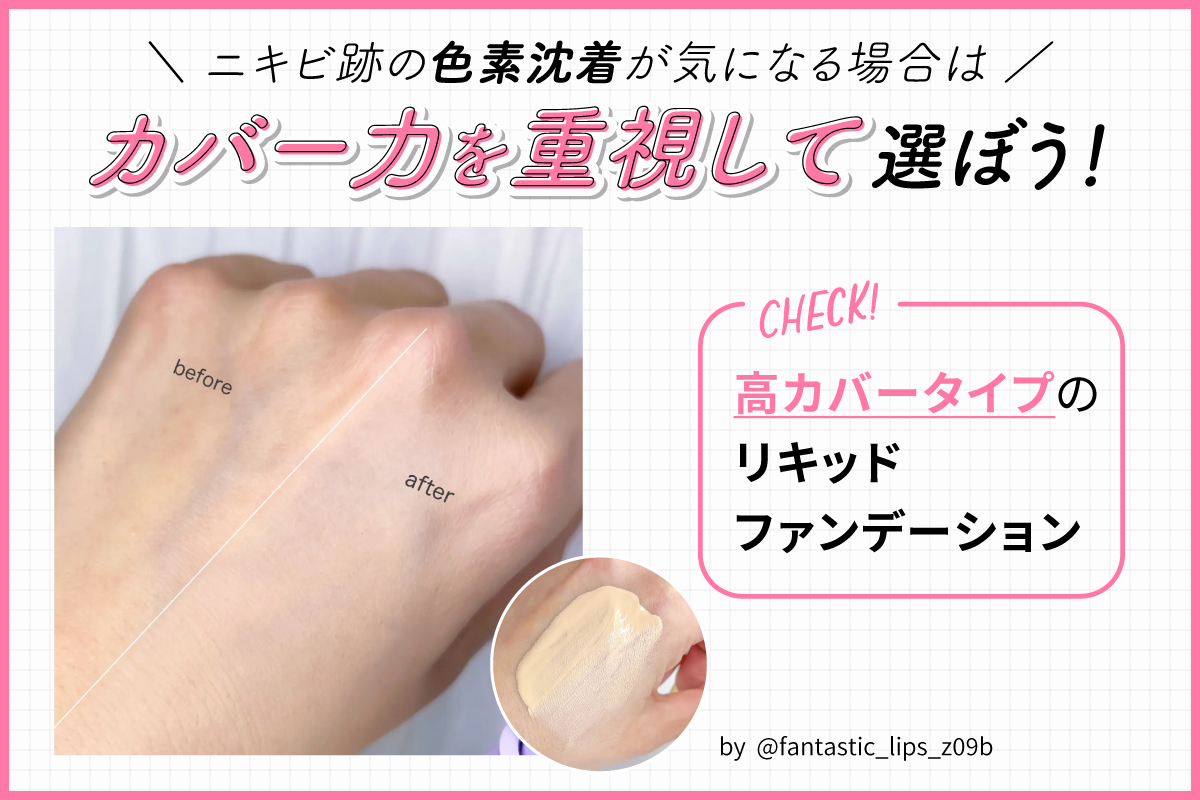 ニキビ跡の色素沈着が気になる場合はカバー力を重視して選ぼう！高カバータイプのリキッドファンデーションをチェック。
