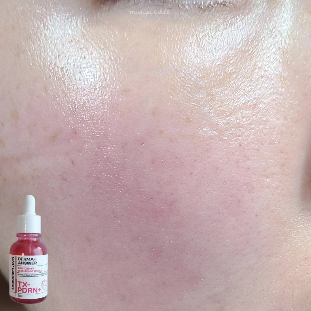 ピンクトーニング™︎ディープインショットアンプル/CNP Laboratory/美容液を使ったクチコミ(5枚目)