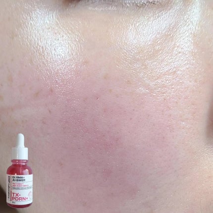 ピンクトーニング™︎ディープインショットアンプル/CNP Laboratory/美容液を使ったクチコミ(5枚目)