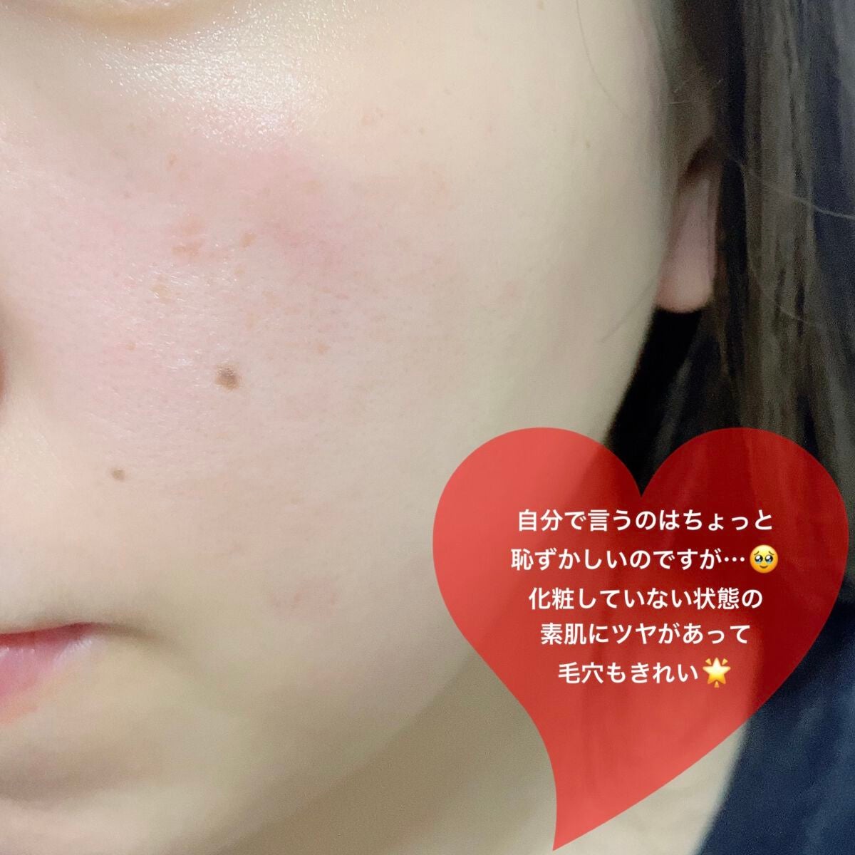 ユース ラディアンス ビタチノール セラム/primera/美容液を使ったクチコミ(3枚目)