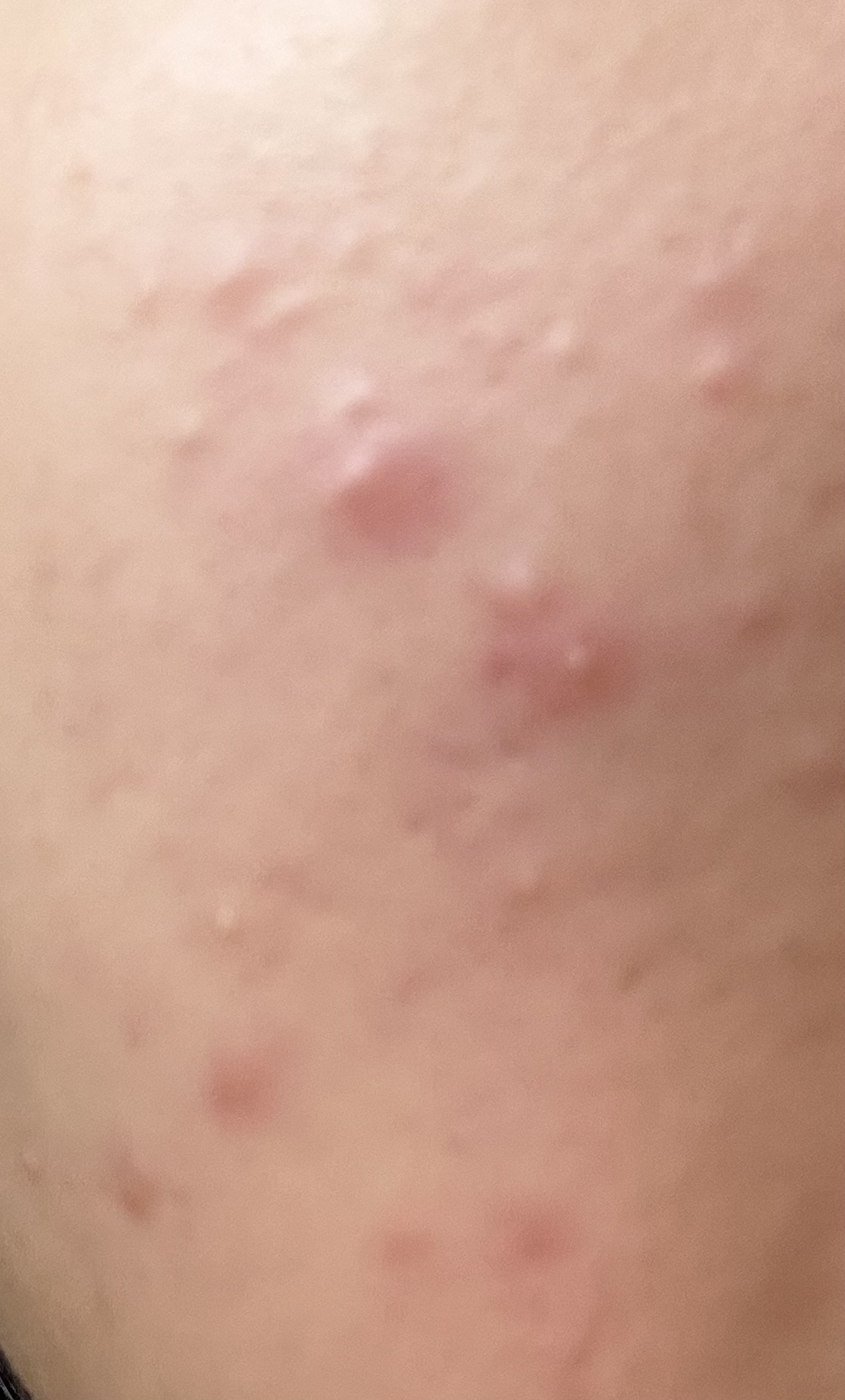 ナチュラルパールマスク/ジャパンギャルズ/シートマスク・パックを使ったクチコミ（2枚目）