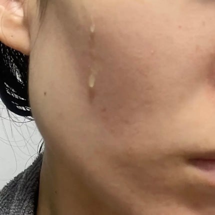 グルタ ビタミンC トーニング アンプル/IOPE/美容液を使ったクチコミ(2枚目)