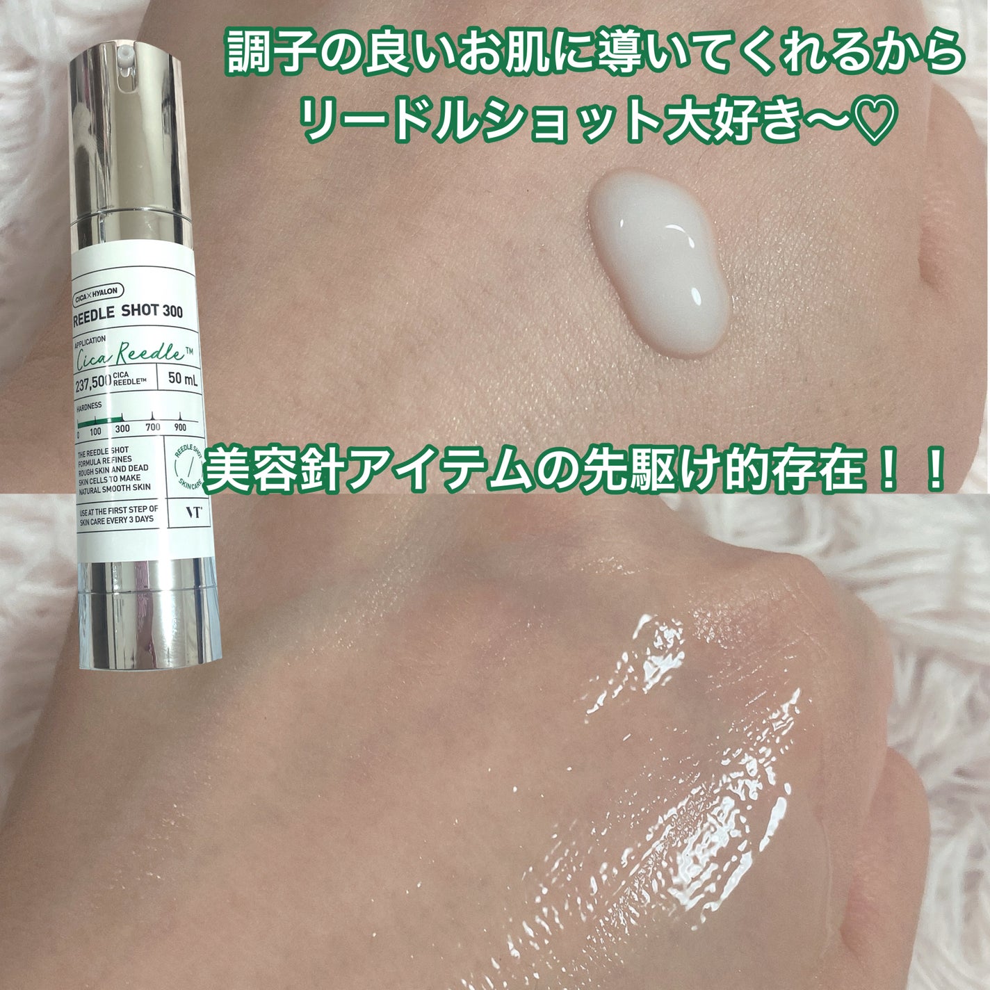 リードルショット300/VT/美容液を使ったクチコミ(2枚目)