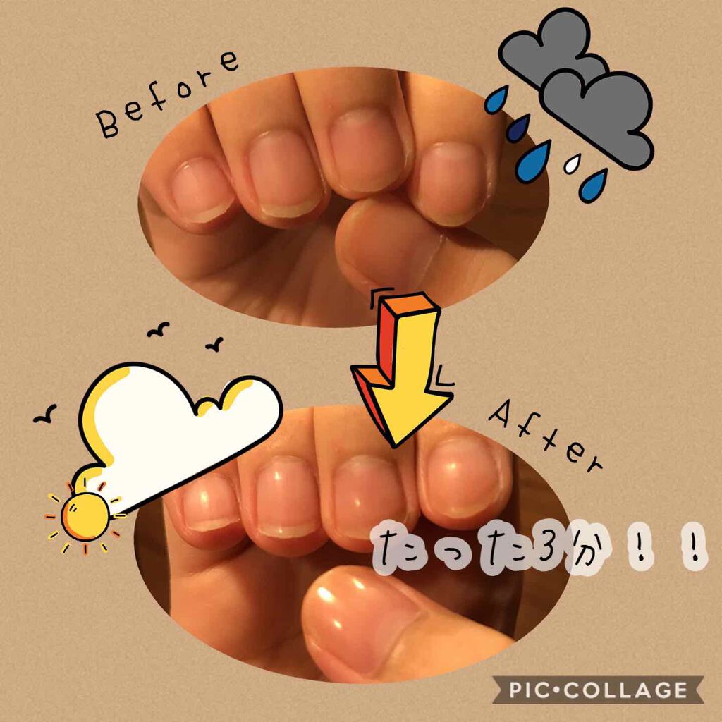 つめみがき/DAISO/ネイル用品を使ったクチコミ（1枚目）