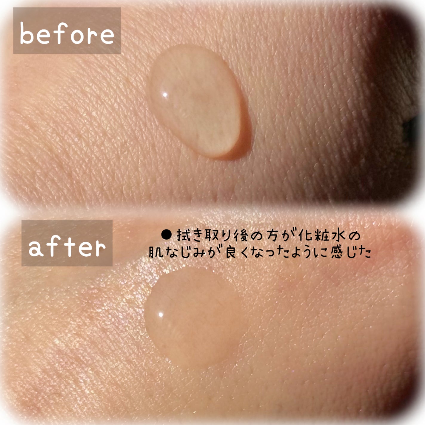 原液ピーリング液/TUNEMAKERS/拭き取り化粧水を使ったクチコミ(3枚目)