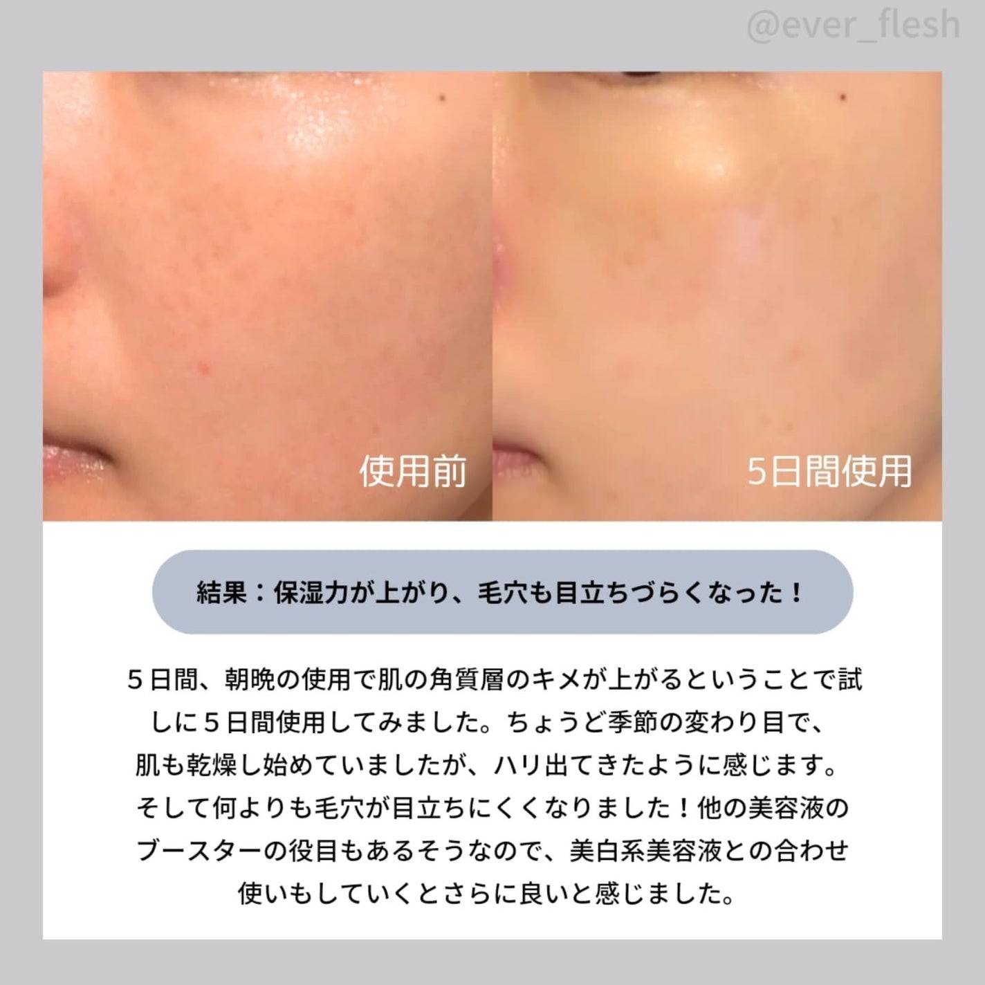 ヒアルブースターセラム (スピキュール)/ilso/美容液を使ったクチコミ(6枚目)