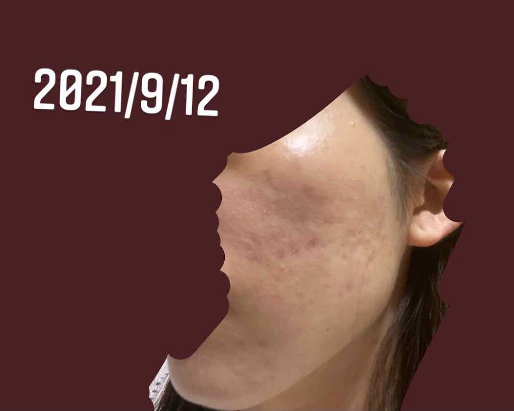 を使ったクチコミ（1枚目）