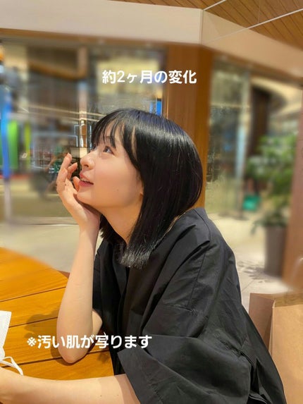 を使ったクチコミ(1枚目)