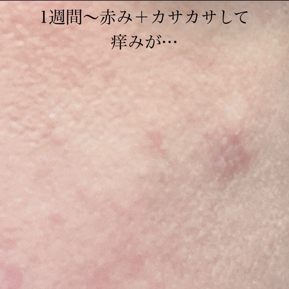 レチノール シカ リペア セラム/innisfree/美容液を使ったクチコミ(5枚目)