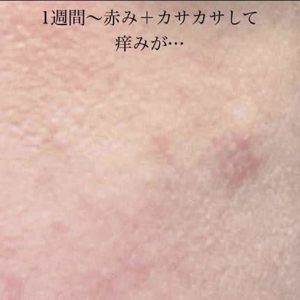 レチノール シカ リペア セラム/innisfree/美容液を使ったクチコミ(5枚目)