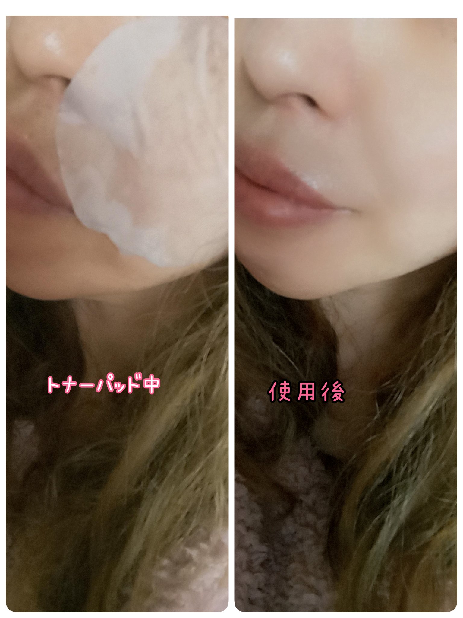 t-ac トナー/VICLE/化粧水を使ったクチコミ（2枚目）