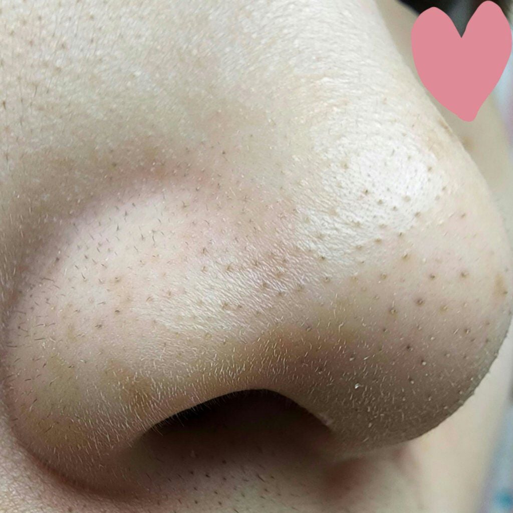 ソフィーナ iP ポア クリアリング ジェル ウォッシュ/SOFINA iP/その他洗顔料を使ったクチコミ(5枚目)